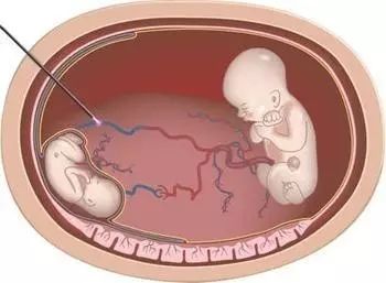 命运列车 推荐视频