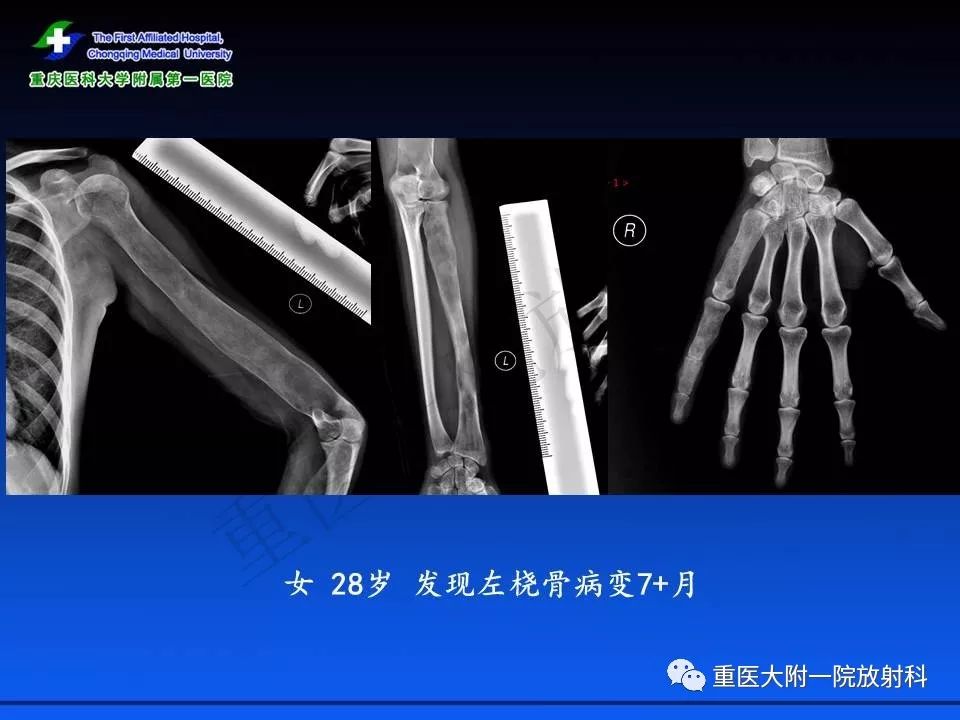 伦敦塔闹鬼 视频主图